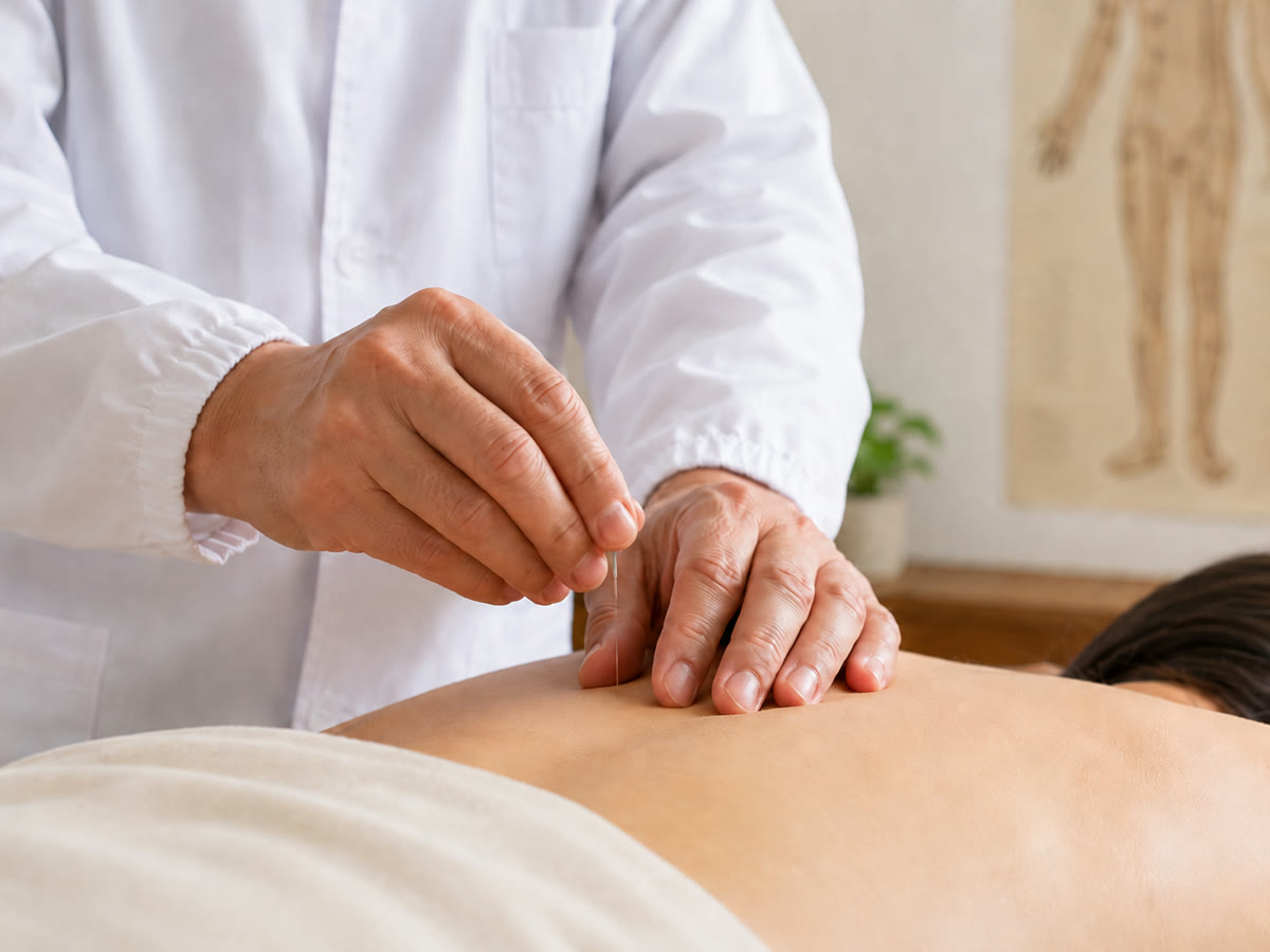 Licensed acupuncturist placing fine needles for pain and stress relief at Woodroffe Health Centre in Nepean, Ottawa